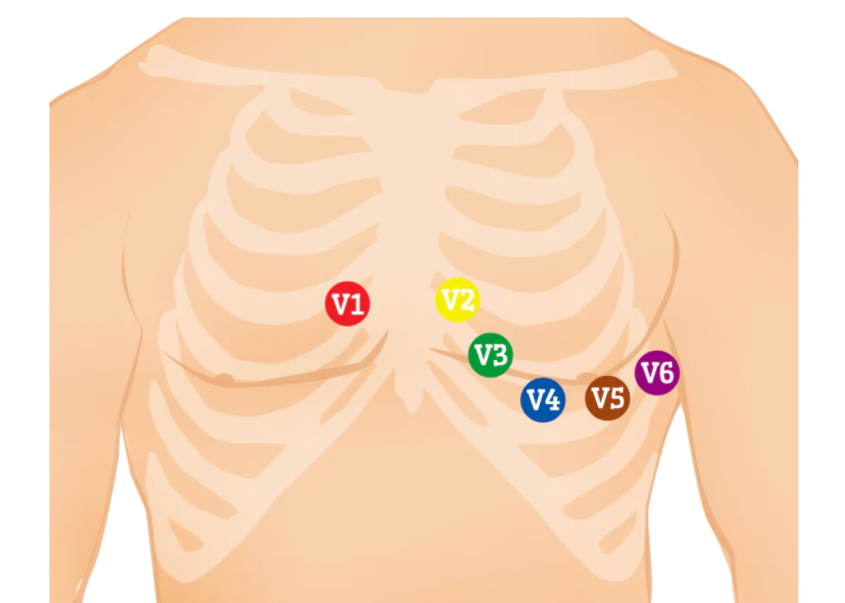 ECG leads